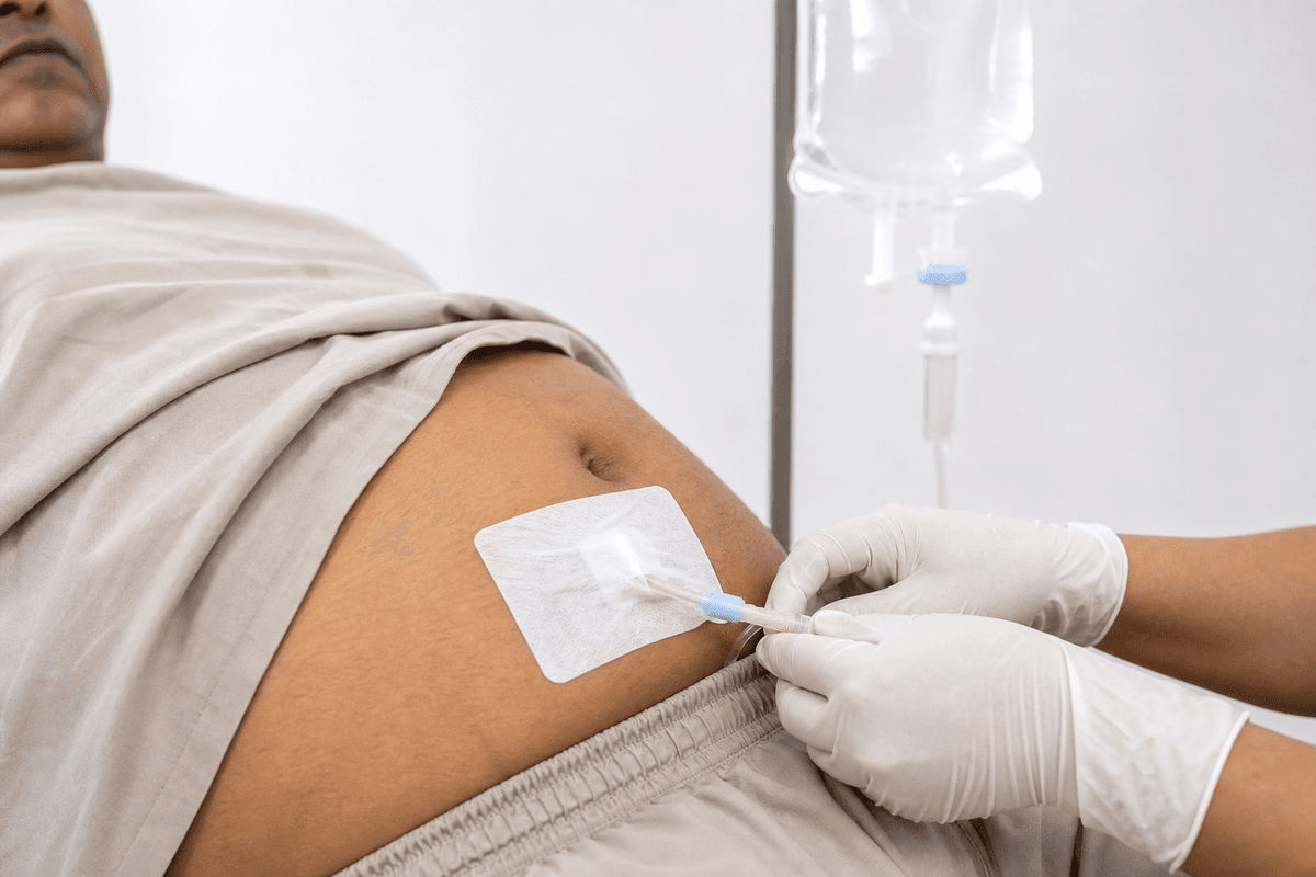 Peritoneal Dialysis